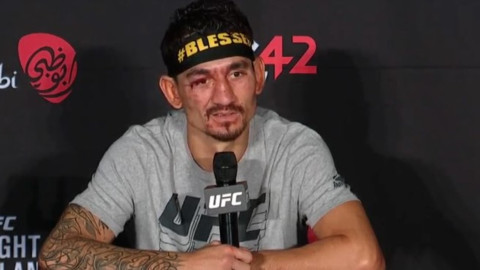 Max Holloway shows off leg injury days after UFC 300