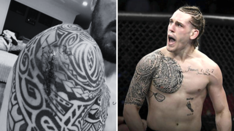 UFC contender riddled with gruesome staph infection