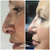 UK’s Five Star DermBeau Medical Aesthetics Comes To Lagos And Abuja