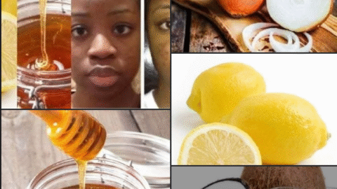 NATURAL WAYS TO REMOVE BLACK SPOTS :IT WORKS LIKE MAGIC