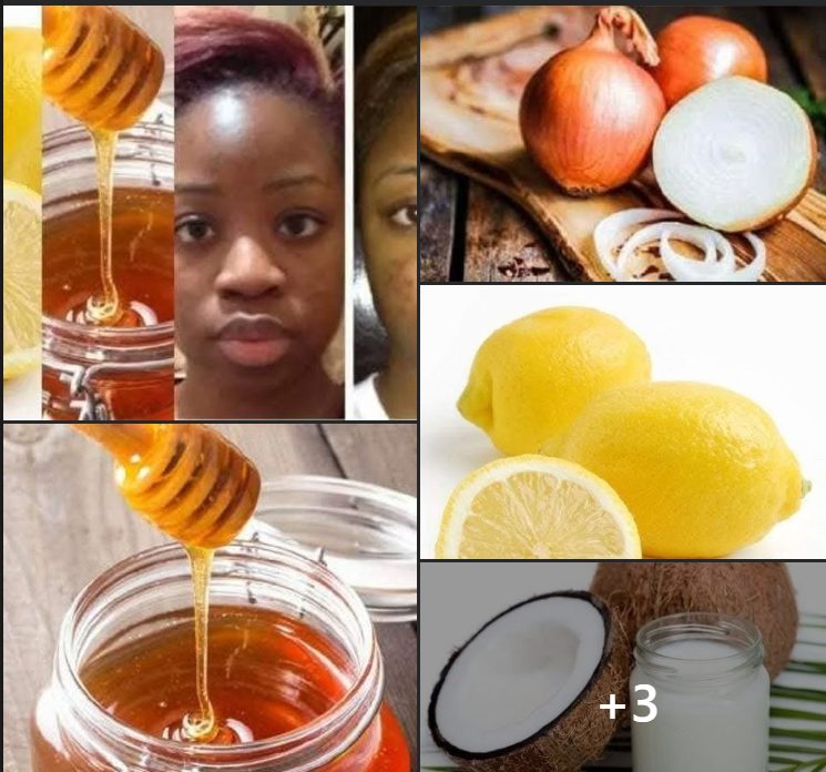 NATURAL WAYS TO REMOVE BLACK SPOTS :IT WORKS LIKE MAGIC