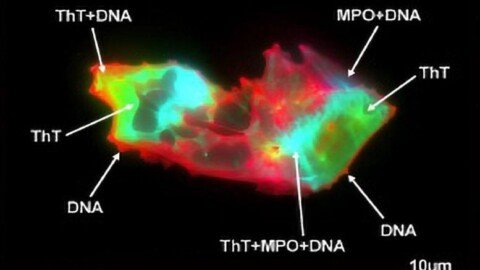 Scientists Uncover Hidden Blood Pattern in Long COVID