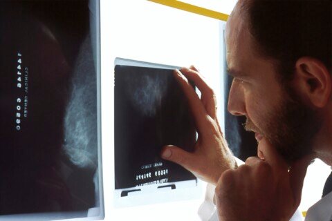 Anti-Cancer Drugs Often Fail to Meet Expectations | Mirage News