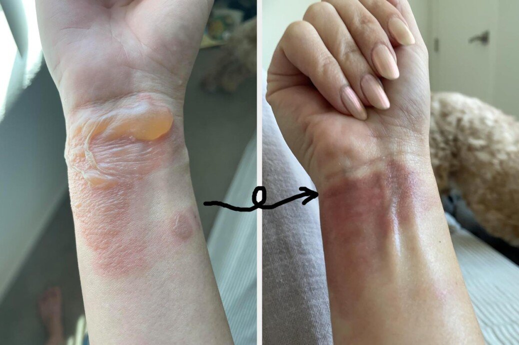 36 Products With Results So Dramatic, Your Eyebrows Will Reach Your Hairline With Shock