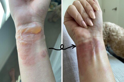 36 Products With Results So Dramatic, Your Eyebrows Will Reach Your Hairline With Shock