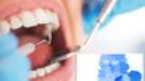 Getting an NHS dentist in England now ‘almost impossible’, damning report finds